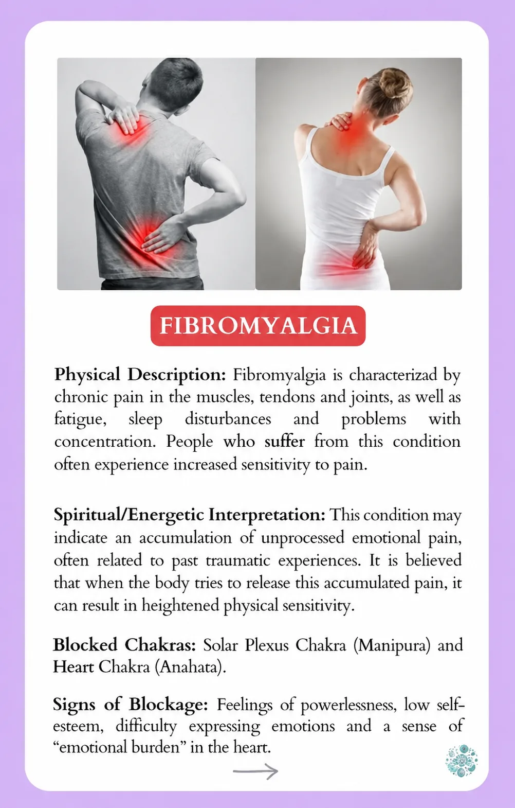 Preview: Fibromyalgia